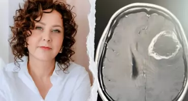 Brutalna diagnoza i dramatyczny wyścig z czasem. 49-latka z naszego regionu walczy o życie
